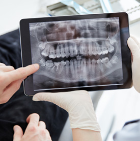 a dentist and patient reviewing an X-ray