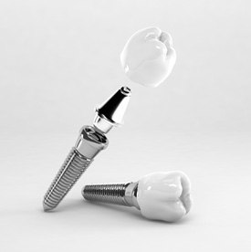 an assortment of dental implant parts
